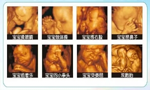 淮阳豫生四维彩超最佳检查时间